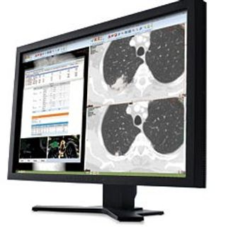 MD Buyline Report Cites Top Rating for CARESTREAM Vue PACS