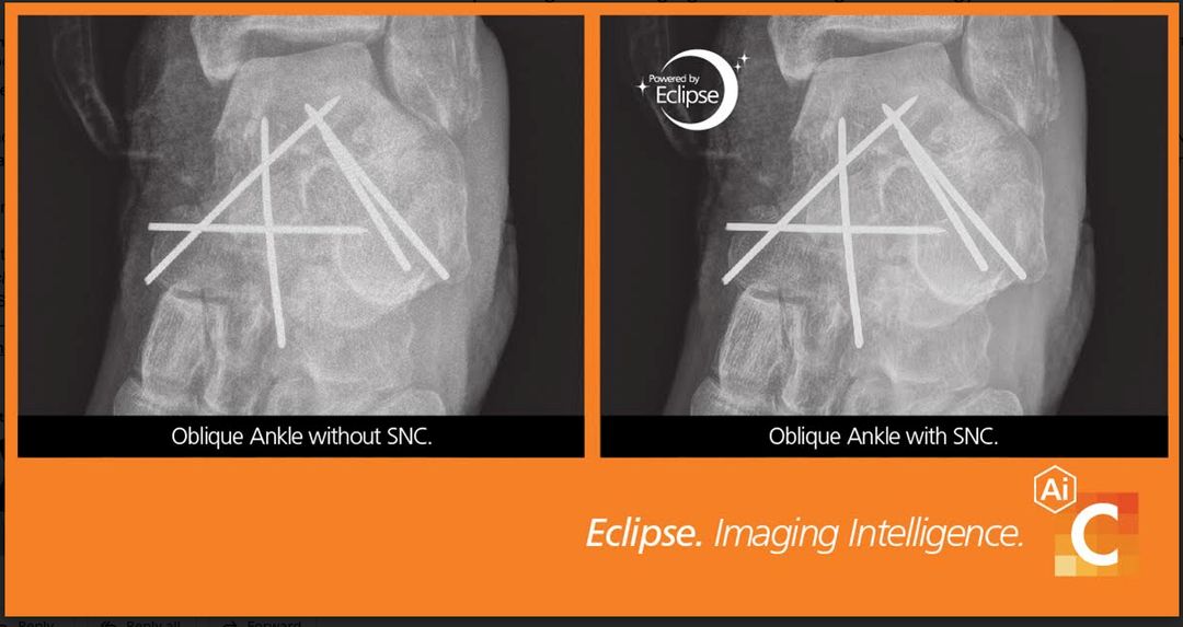 Carestream Demonstrates Leadership in Diagnostic Imaging at Worlds