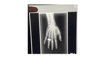 Historic Image: The First X-ray in Space Is Here Historic Image: The First X-ray in Space Is Here