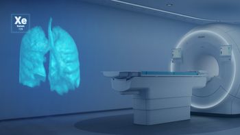 Study Demonstrates Xenon MRI Predicts Cystic Fibrosis...