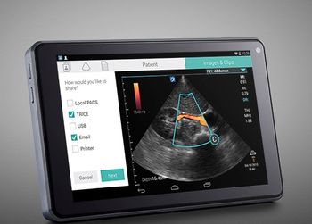SonoSite iViz