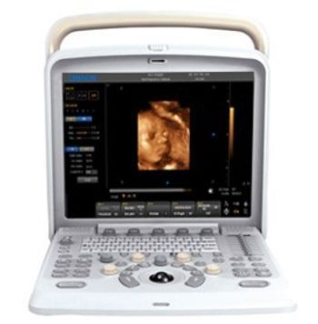 Chison Q5