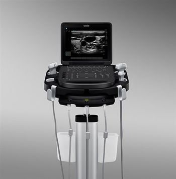 SonoSite Edge II