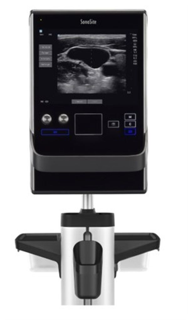 SonoSite - SII