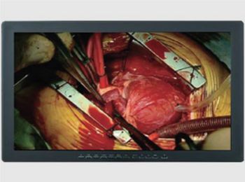 Skytron Optik View 24