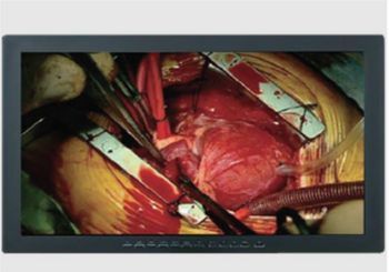 Skytron Optik View 26