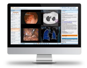 Carestream Vue Archive