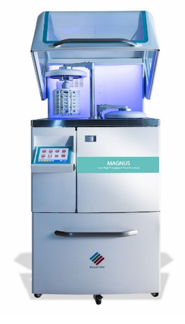 Milestone - MAGNUS