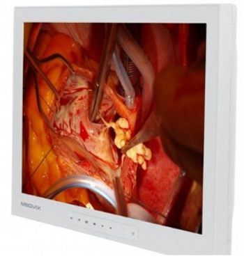 Ampronix Medvix AMVX1908HD