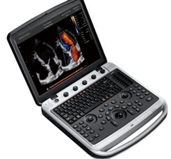 Chison SonoBook 9
