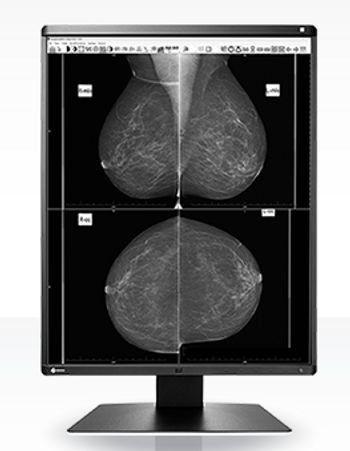Eizo RadiForce GX560