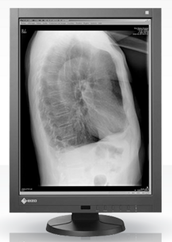 Eizo RadiForce GX240