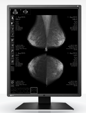 Eizo RadiForce RX850