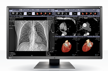 Eizo RadiForce MX315W