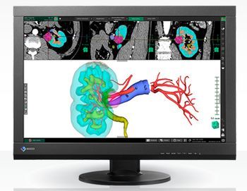 EIZO 24型液晶モニター RadiForce MX242W昇降・回転可能 EIZO 24型液晶モニター RadiForce MX242W昇降・回転可能 - メルカリ