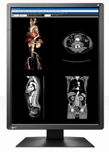 Eizo RadiForce MX216