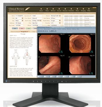 eizo mx191