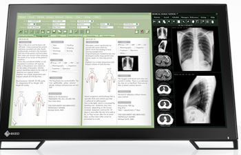 eizo radiforce ms235wt