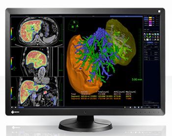 Eizo RadiForce RX650