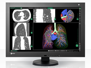 Eizo RadiForce RX440