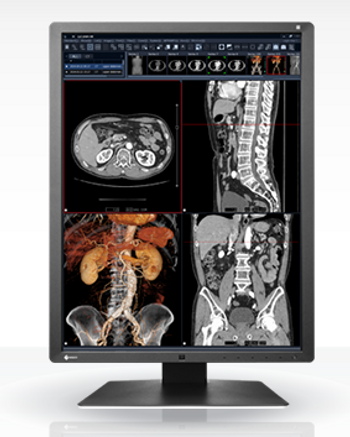 Eizo RadiForce RX250