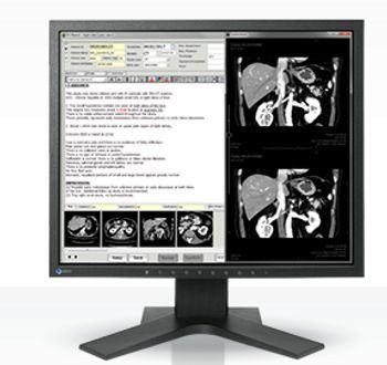 Eizo RadiForce MX194