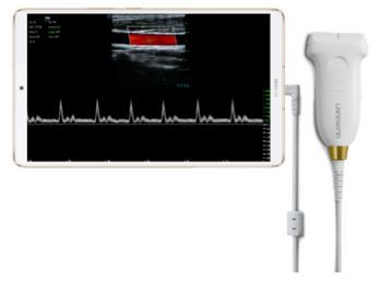 Landwind Medical Umagic S
