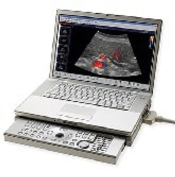 Aloka ProSound C3CV