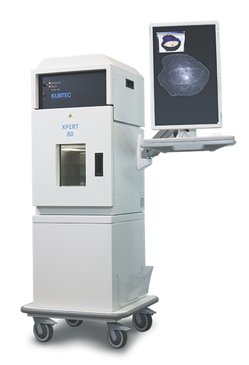 Kubtec Medical Imaging - XPERT 80