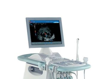 Esaote My Lab 15/20 XVision
