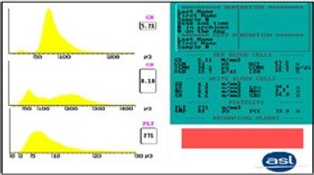 Ysebaert - Hema Star II