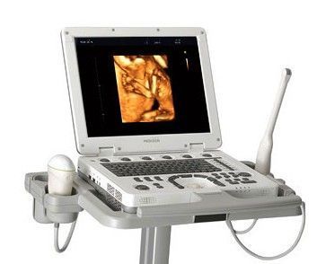 Medison - MySono U5 Medison - MySono U5
