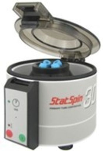 Iris International - StatSpin 30