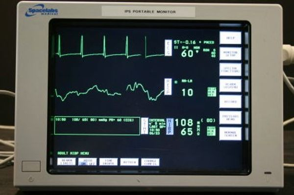 Manual De Uso Y Operación - Spacelabs 90367 Ultraview 