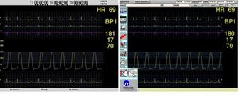 Mennen Medical HORIZON SE LITE