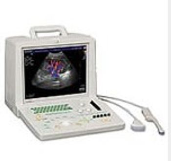 SonoScape SSI-1000