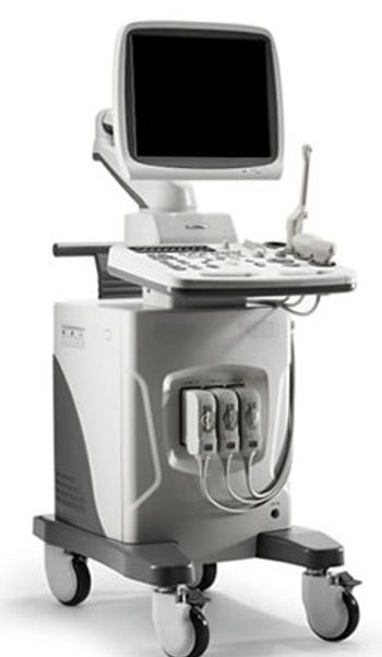 SonoScape SSI-6000